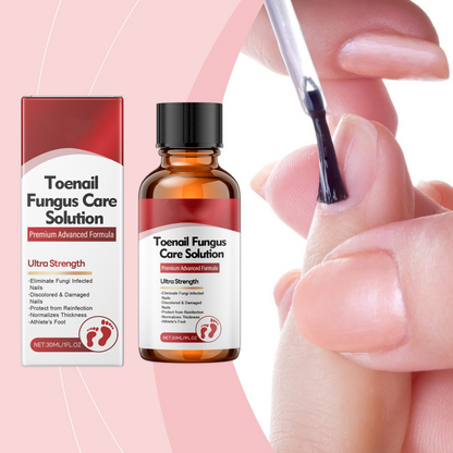 💥Limited-Time Offer:64% OFF!!!💥Nail Repair Essence for Damaged Nails💅🏻