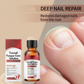 💥Limited-Time Offer:64% OFF!!!💥Nail Repair Essence for Damaged Nails💅🏻